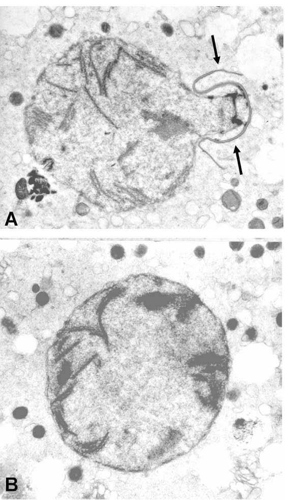 Figure 7. Pronuclei developed from human spermatozoa, 30 min (A) and 60 min (B) after ICSI. Remnant of the acrosome (arrows) still covers part of developing pronucleus at 30 min after ICSI.