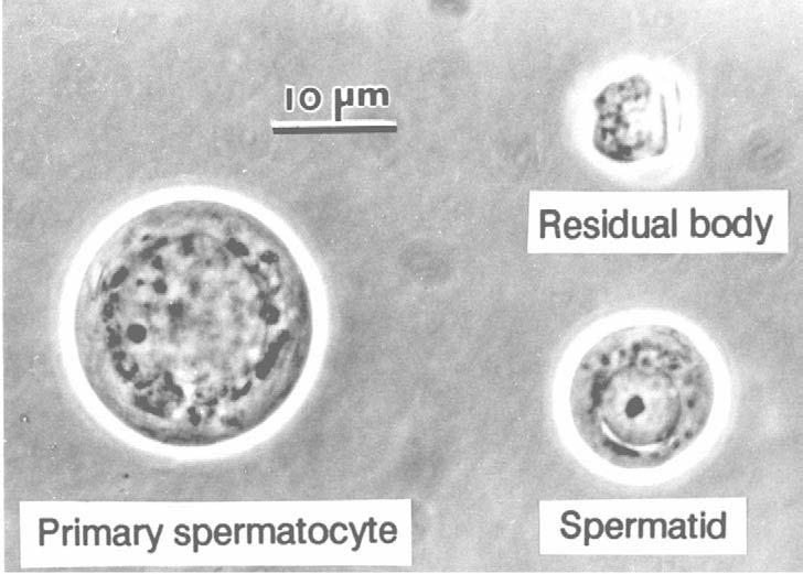 Figure 12. Mouse round spermatid and primary (pachytene) spermatocyte.