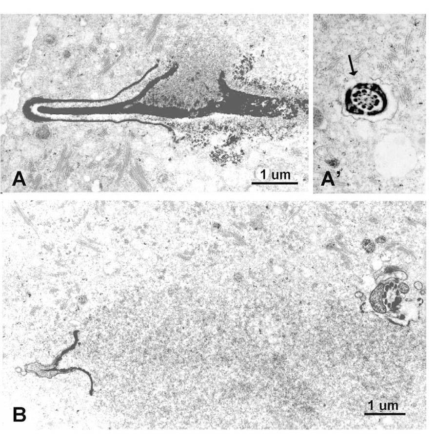 Figure 3. Electron micrographs of mouse spermatozoa injected into oocytes.