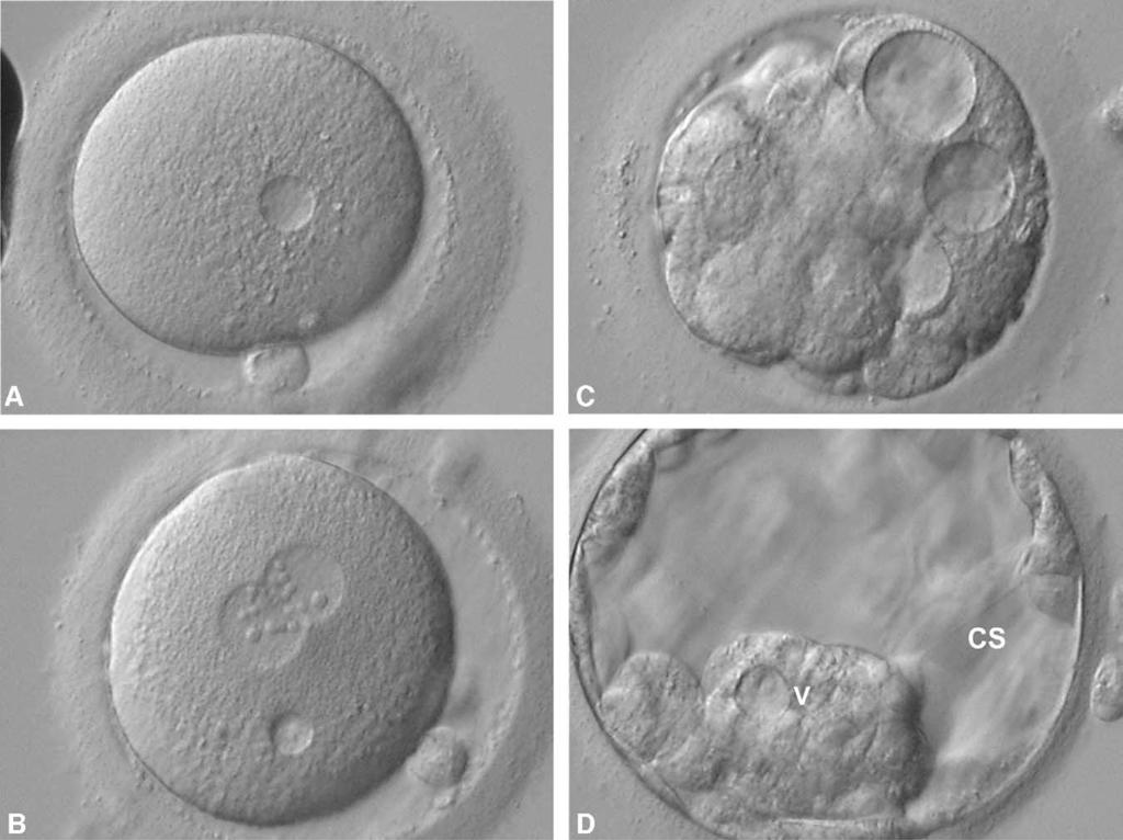FIGURE 1 Vacuolization throughout preimplantation development. (A) Vacuole (17 m) in MII oocyte. (B) Ten- m vacuole at zygote stage. (C) Compacting embryo with severe vacuolization (22 35 m).