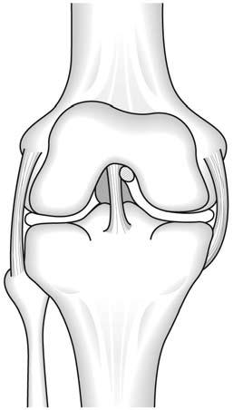 performed for lesions of the meniscus, and it is likely that many more remain untreated every year.