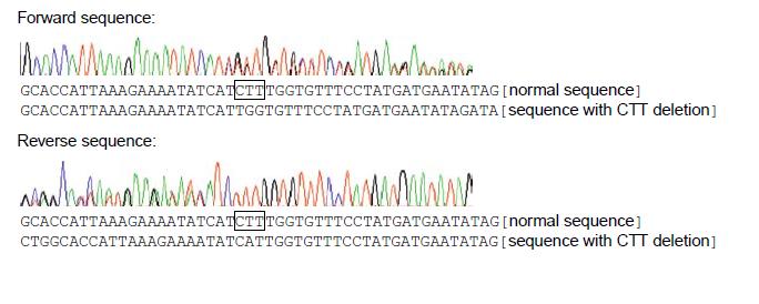 CFTR sequence analysis of the