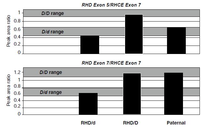 RHD zygosity analysis of the