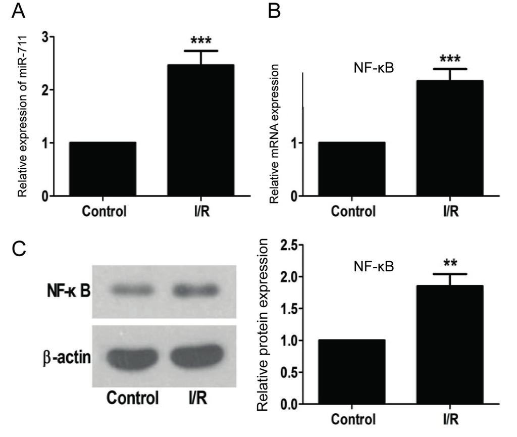 NF-κB pathway by mir-711 in the apoptosis of H9c2 cardiomyocytes Detection of Cell Proliferation Activity The cells in logarithmic phase were collected and cultured in a 96-well plate (5 10 4
