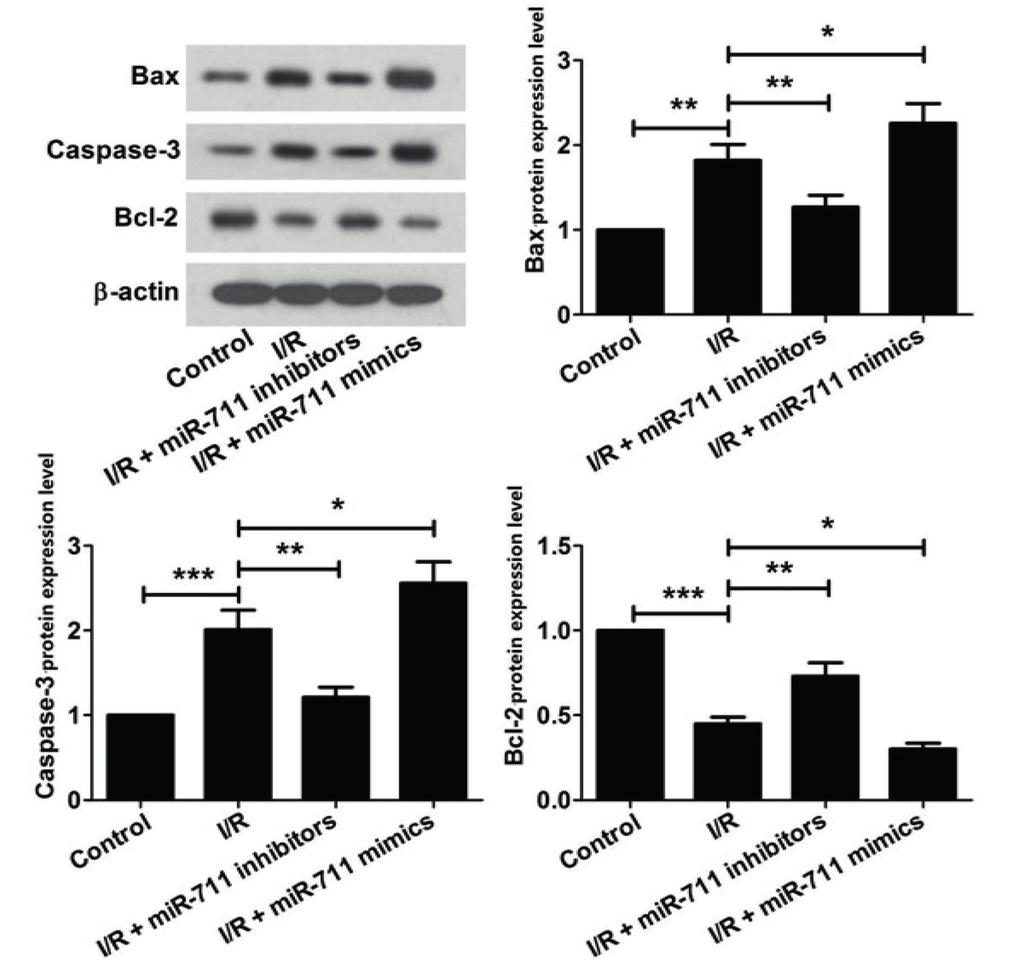 NF-κB pathway by mir-711 in the apoptosis of H9c2 cardiomyocytes I/R injury plus mir-711 inhibitors were lower, the expression level of Bcl-2 was higher.