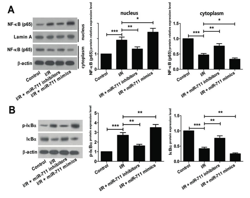 J.-R. Zhang, H.-L. Yu Figure 4. mir-711 promoted the apoptosis of H9c2 cardiomyocytes induced by I/R injury through NF-κB activation.