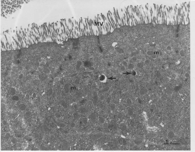 TEM micrograph showing bacteria-like profiles (arrows) in the subapical cytoplasm of midgut