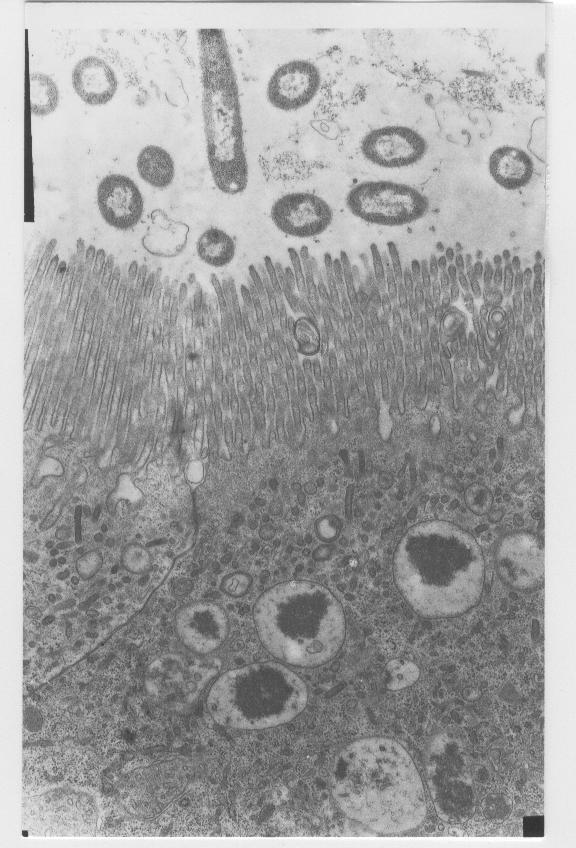 Endocytosis of bacteria in enterocytes in posterior part of the hindgut of a 14-day day-old herring ( (Clupea harengus L.) larva.