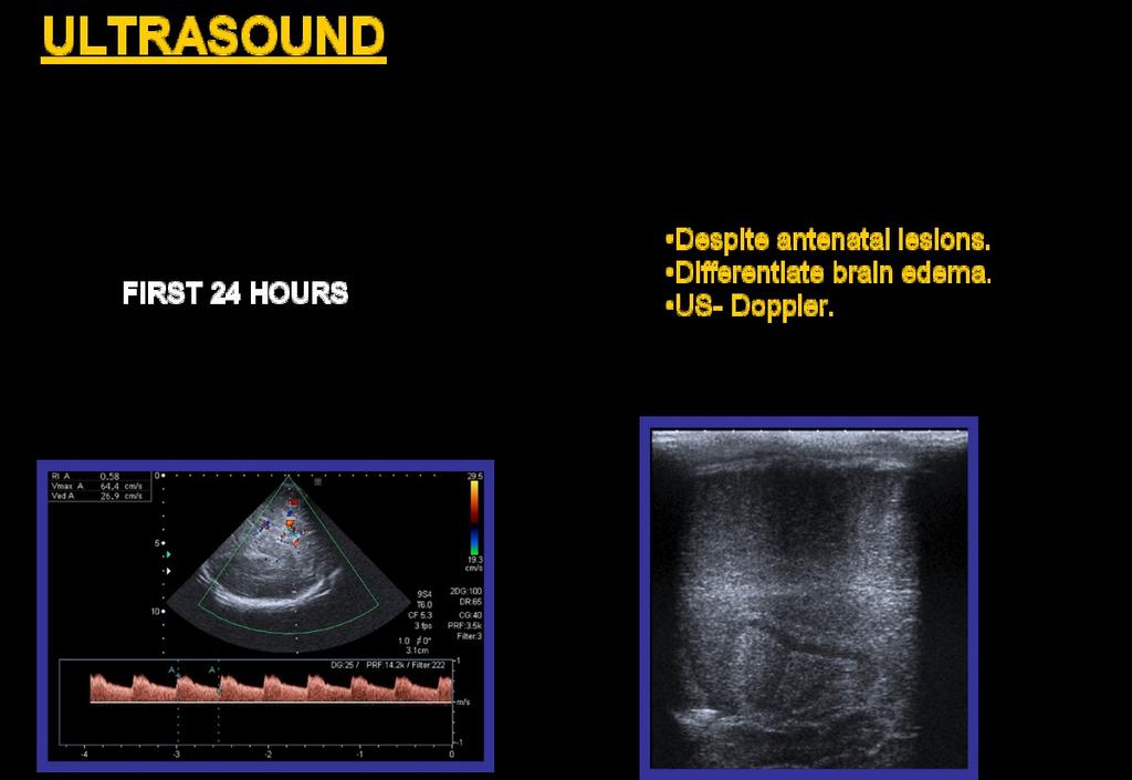 Fig. 2: We performed first ultrasound in the first 24