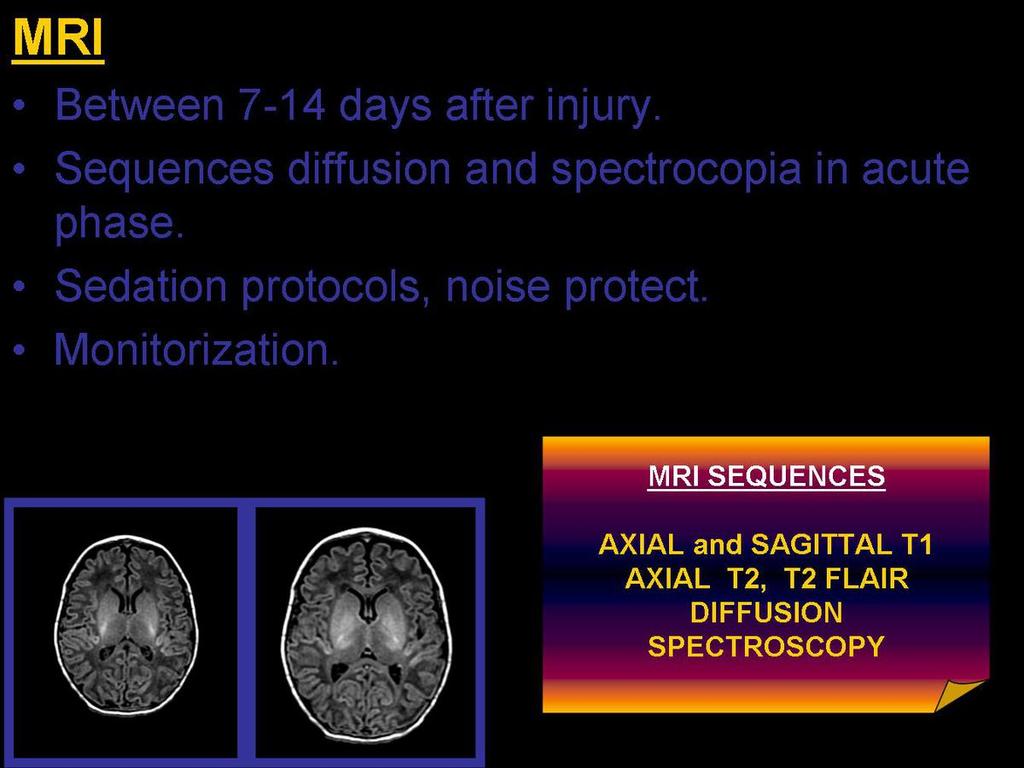 Fig. 4: MRI is esential in encephalopathy ischaemic-hipoxic study.