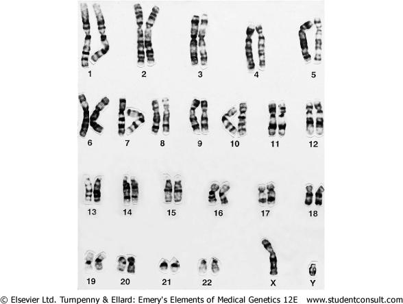 G BANDING Most common use In the Metaphase chromosome treated with trypsin Then stained with Giemsa R band Stain light GC rich have the highest gene density G bands Stain dark AT rich have relatively