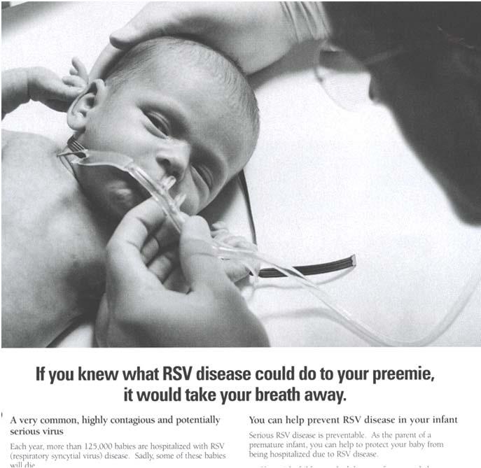 Development of live attenuated pediatric RSV vaccines Laboratory of Infectious