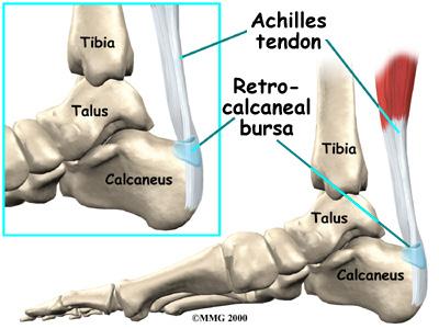 This guide will help you understand where the condition develops how it causes problems what can be done for your pain Anatomy What part of the foot is affected?