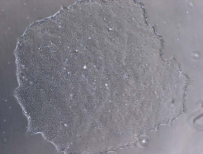 Image 1: Typical image of a human induced pluripotent stem cell