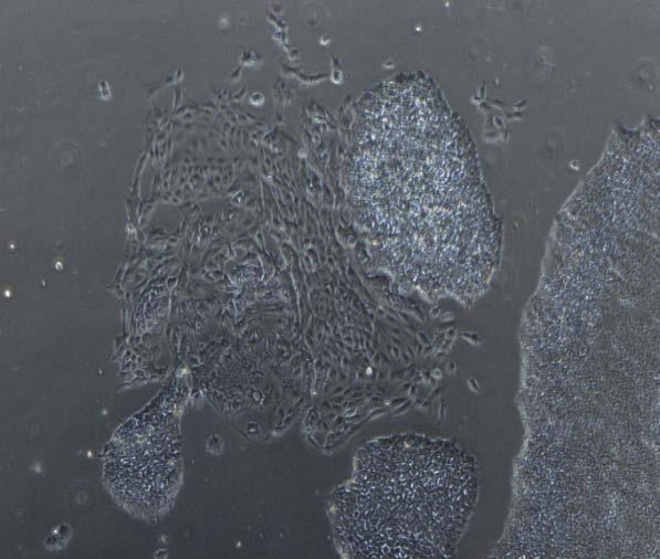 Note the distinct borders of the colony and morphology of the ipscs.