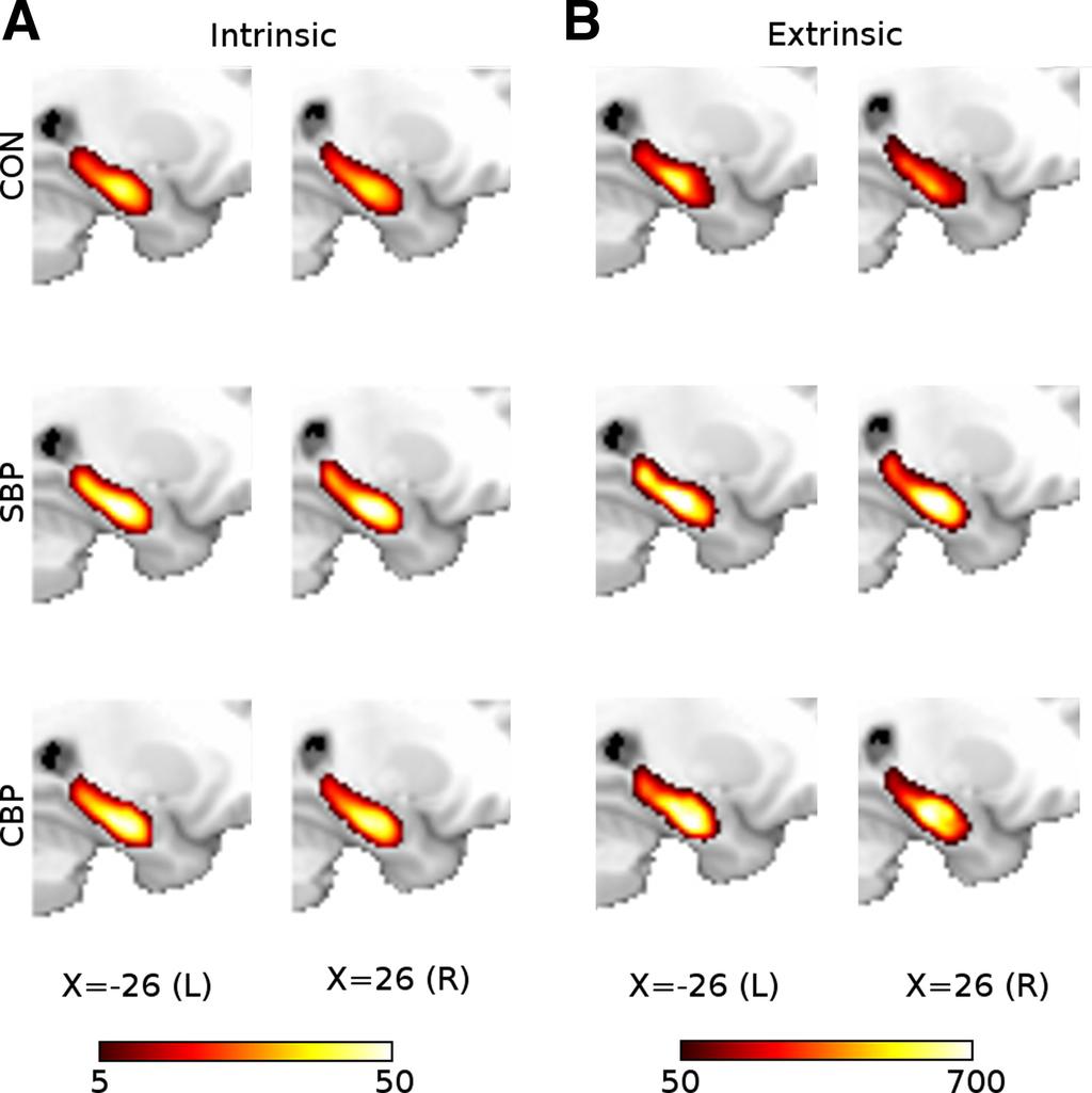 HIPPOCAMPAL FUNCTIONAL CONNECTIVITY AND PAIN 1069 Fig. 2.