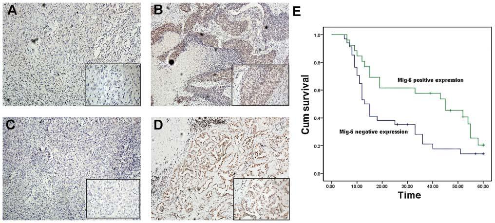 ONCOLOGY REPORTS 31: 1707-1714, 2014 1709 Figure 1. Expression of Mig-6 in NSCLCs and prediction of poor prognosis. Immunohistochemistry was performed to determine the expression of Mig-6.
