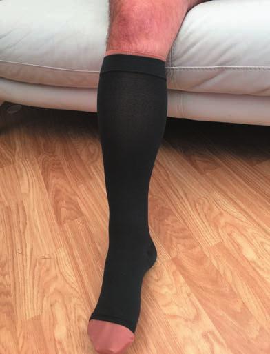 footwear and use of cosmetically acceptable hosiery can increase patient confidence and self-esteem when socialising, working or exercising (Tickle 2014).