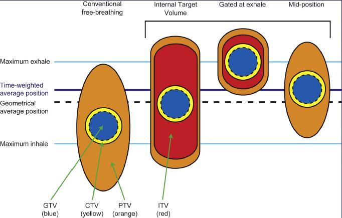 Strategies of RT Delivery to Account for Respiratory Conventional (ITV-based) Contour and treat full tumor ROM Accelerator beam gating Motion Patient breathes normally; beam only on while patient is
