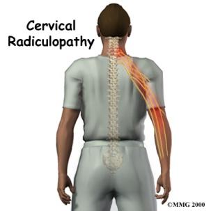 Jackson is the only spine surgeon in the Kansas City area that focuses specifically on the cervical spine, which has furnished data from thousands of procedures leading to the formulation of these