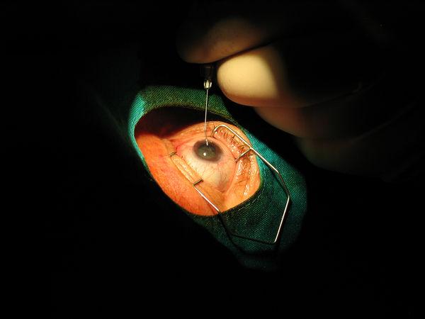 Applications in Dermatology, Dentistry and LASIK Eye Surgery using LASERs http://www.