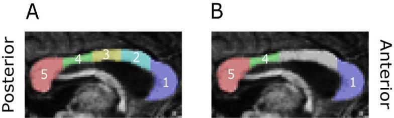 Effects of Prenatal Alcohol Exposure on Corpus Callosum Volume. Segmentation of the corpus callosum (A), in which some portions (1, 4 and 5) exhibited the general PAE effect (B).