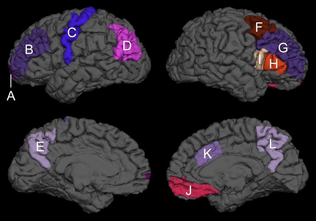 Program #: 4344 PCE Effects on Brain Structures Cortical regions affected by Prenatal Cocaine Exposure Left hemisphere A: Frontal Pole, B: Rostral Middle Frontal Gyrus, C: Precentral Gyrus, D: