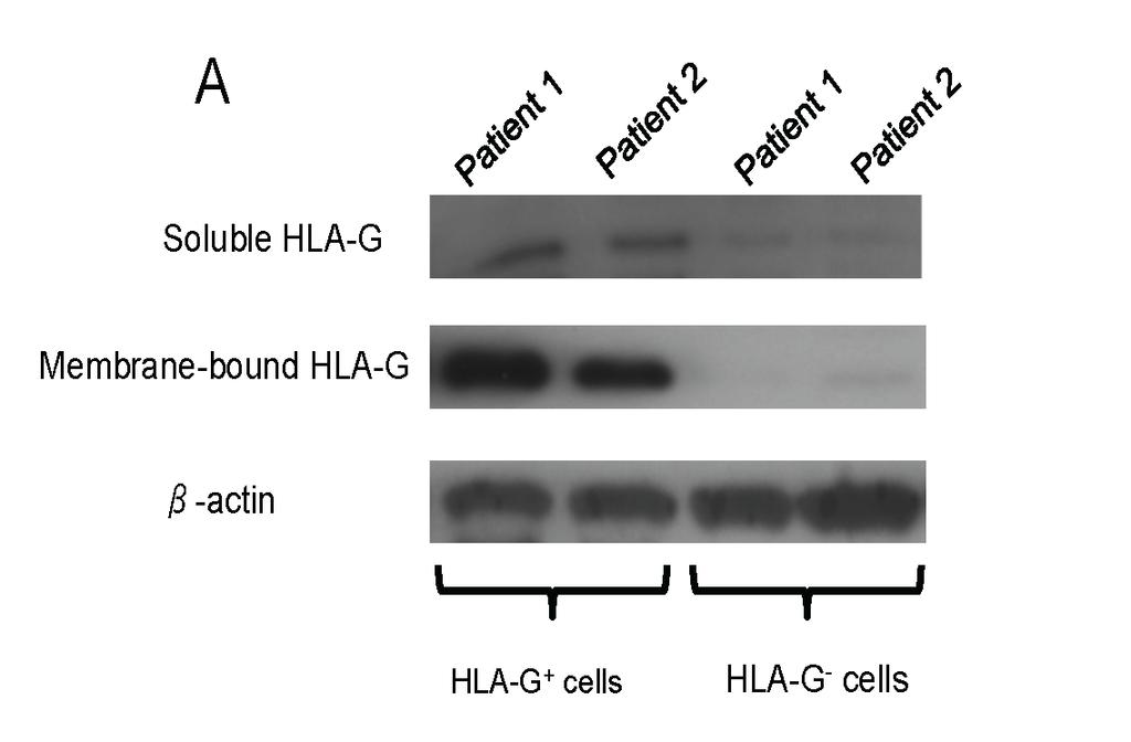 extention Figure 2-24. Expression of soluble and membrane-bound HLA-G in culture.