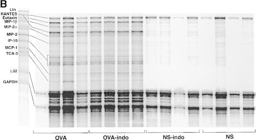 (B) RNase protection assay showing cytokine mrna present in lungs harvested on Day 18.