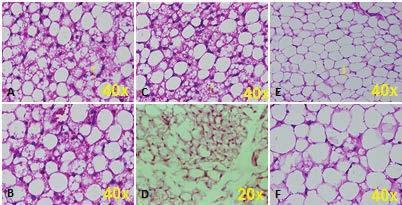 10 great number of intercellular capillaries makes brown fat very different from white fat.