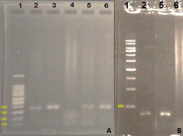 11 Picture 2. Result of PCR A - 1.Ìàrker /100bp/, 2,3. Fetal thoracic brown fat, 5,6.Thoracic BAT of neonate /350bp/ B - 1. Ìàrker /500bp/, 2.Perirenal BAT of lamb, 5.