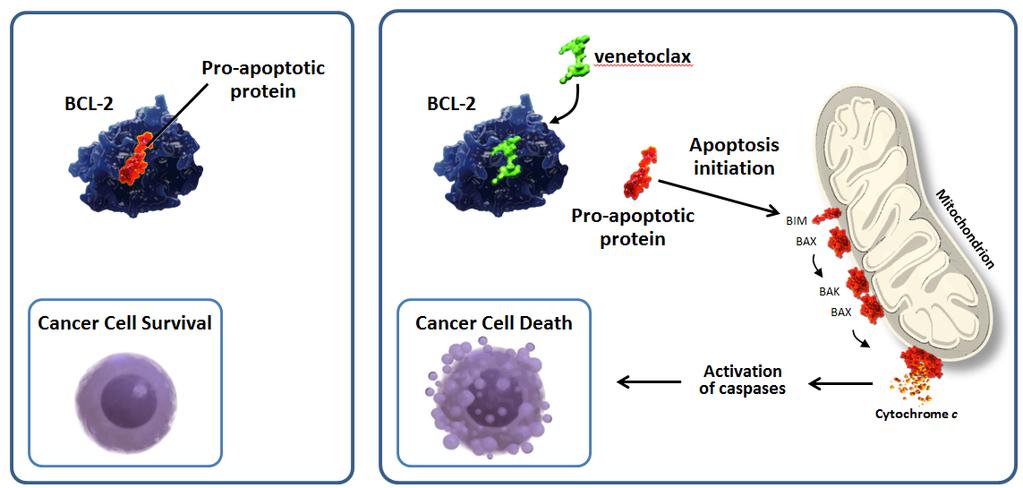 MoA: Venetoclax* (BCL-2 inhibitor) Restoration of apoptosis through BCL-2 inhibition BCL-2 overexpression allows cancer cells to evade apoptosis by sequestering pro-apoptotic proteins.