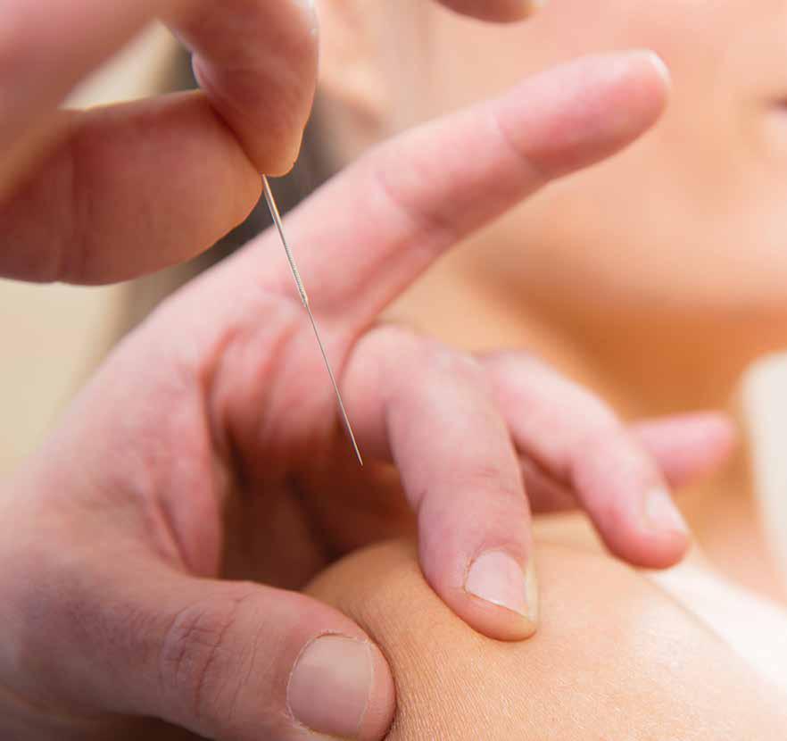 Effective Treatments from Ancient Practices Acupuncture is one aspect of Traditional Chinese Medicine (TCM), the practice of which began over two millennia ago.