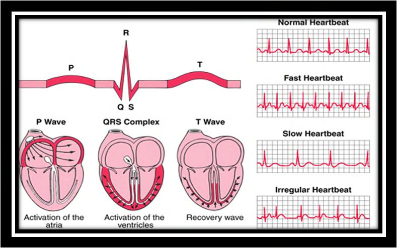 http://www.biologycorner.com/anatomy/circulatory/images/ecg03.gif Autonomic function can be evaluated with bedside cardiac monitoring.