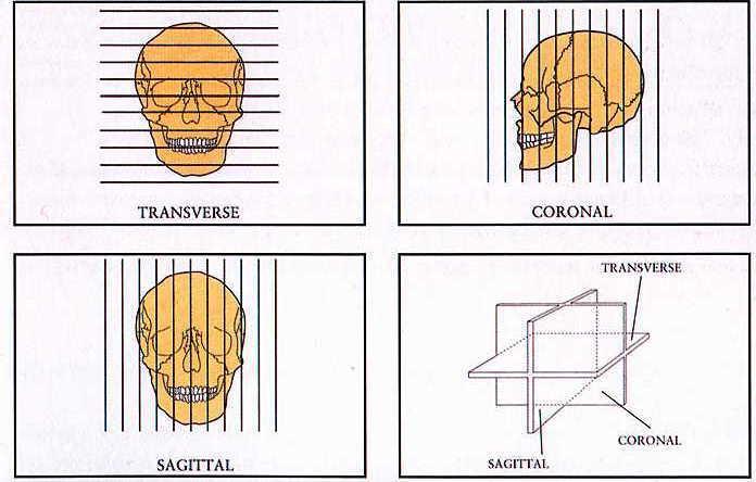 Perfuzijska scintigrafija možganov Standardne