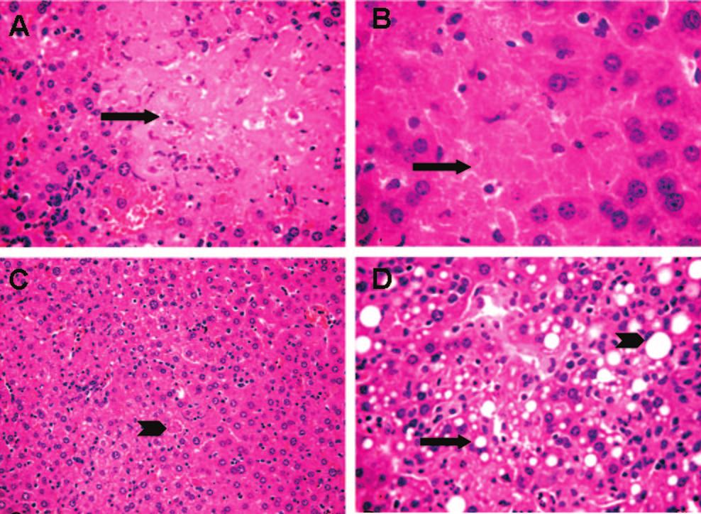 1850 ISMAIL ET AL. INFECT. IMMUN. FIG. 3. Markedly decreased liver injury/apoptosis in TNFR I/II / mice.