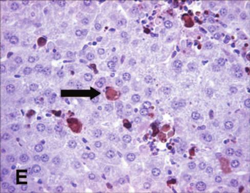 Extensive necrosis was observed in wild-type and anti-tnf- -treated mice (arrows), while few apoptotic cells were detected in TNFR I/II / mice (arrowhead). H&E staining is shown.