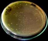 Result of Streptococcus mutans colony counting on Brain Heart agar plate IV.