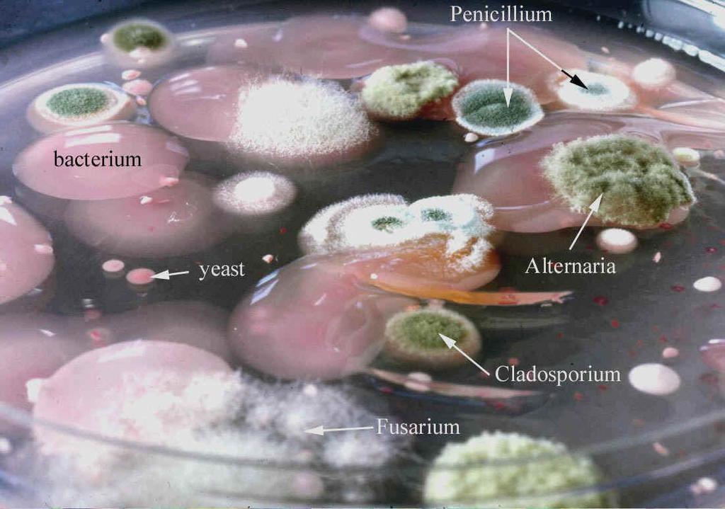 Soil Borne Pathogens- Culturing Non-selective media generally supportive to bacterial and fungal growth, favors saprophytes (soil is dirty) Semi-selective or