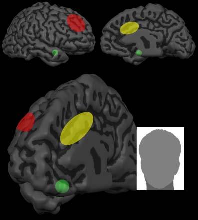 Implicit Attitudes dlpfc: Regulation Lateral Amygdala: Automatic Activation ACC: Detection Medial Socially-relevant stimulus Fig. 2. A model for the neural basis of implicit attitudes.