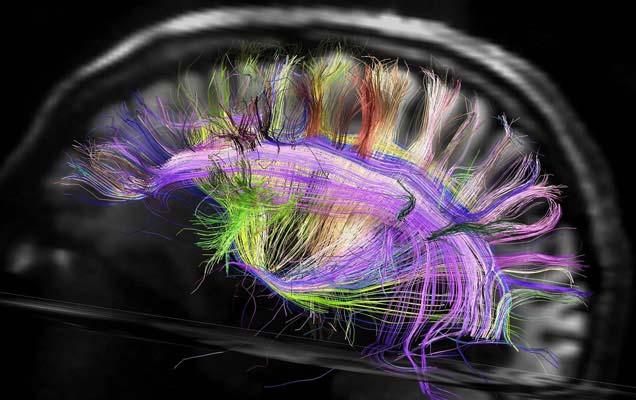 Spectrum Imaging of Brain