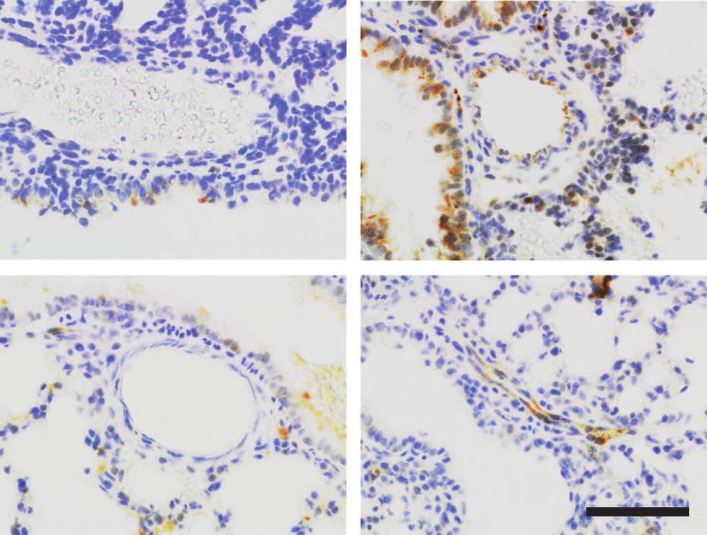 Postntl denosine receptor responses c d Figure 4. increses denosine receptor A1 immunostining compred to mice.