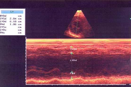 Figure 2 M-mode echocardiogram of the same patient.