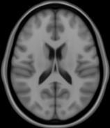 MRI data