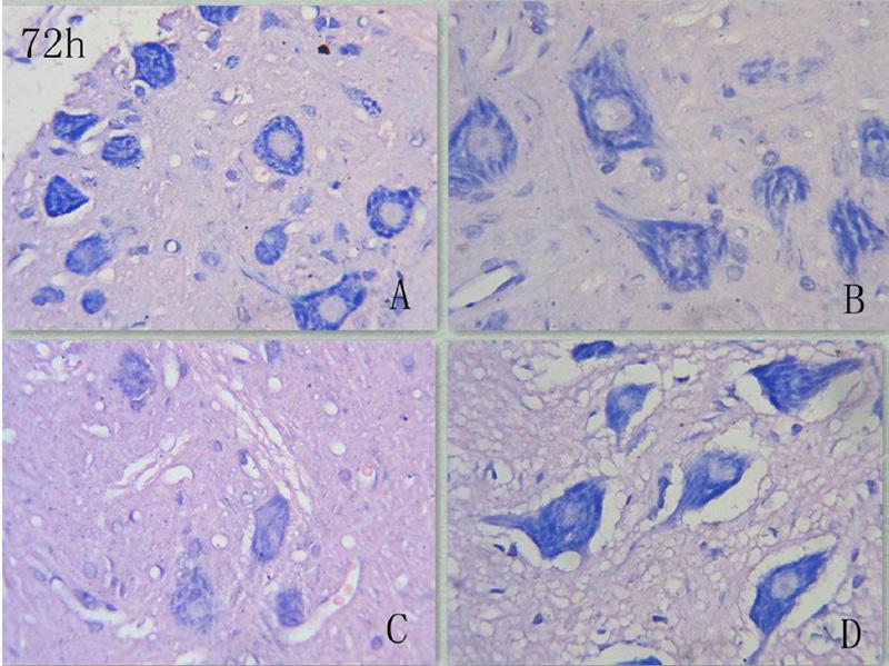 BAX and BCL2 in spinal cord ischemia reperfusion injury rats 10495 Figure 2. Nissl staining after reperfusion for 72 h (40 x 10). A. Low-temperature (18 C) protection group; B.