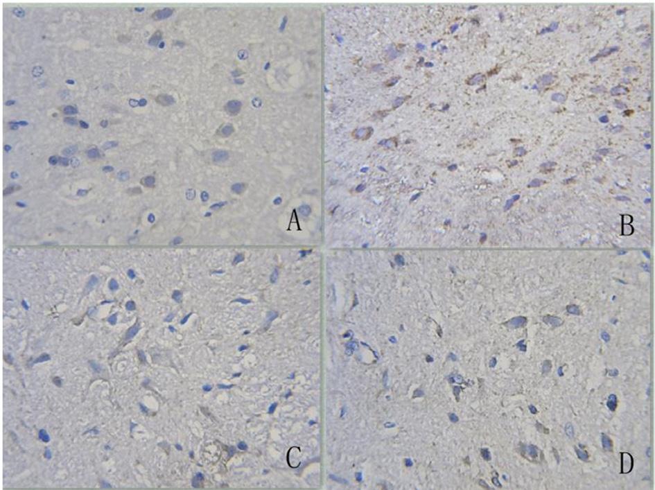 P. Zhu et al. 10496 Figure 4. BAX protein immunohistochemical results (10 x 10). A. Low-temperature (18 C) protection group; B. low-temperature (28 C) protection group; C.