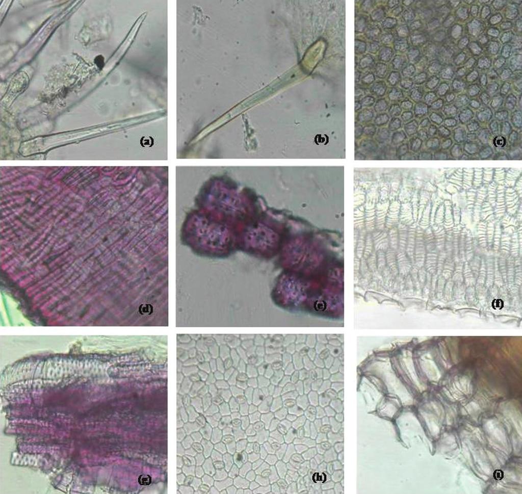 Fig. 2: Powder Microscopy of Fagonia cretica whole plant a) Unicellular covering trichomes occurring in groups. b) Isolated covering trichome with striated cuticle.