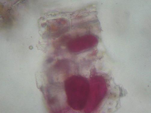 Parenchyma cells with reddish tannin content Sac like Parenchymatous cells Abundant Resin