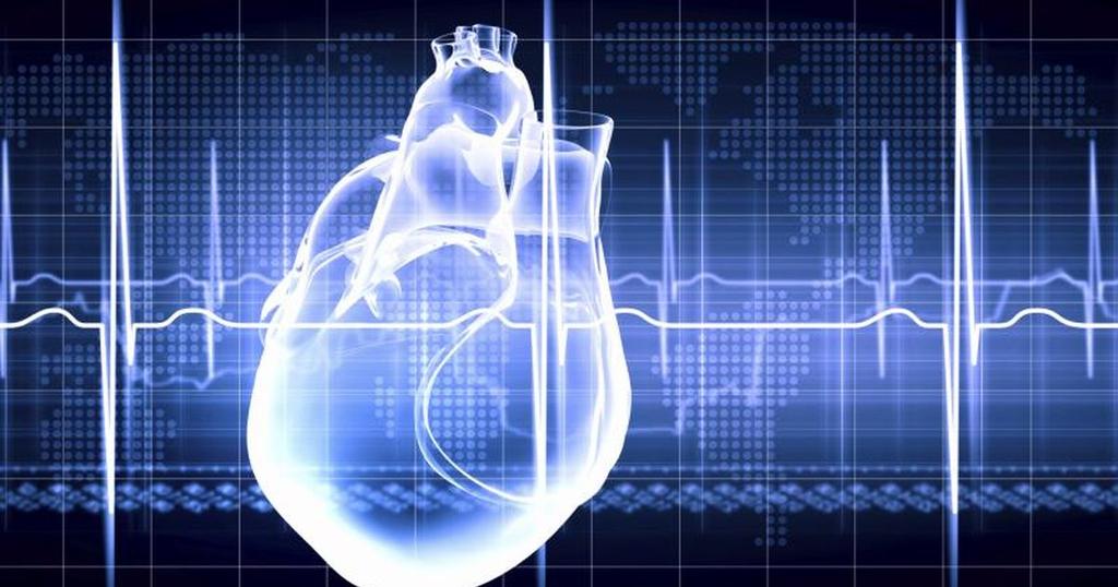 Cardiac Output Monitoring - 6