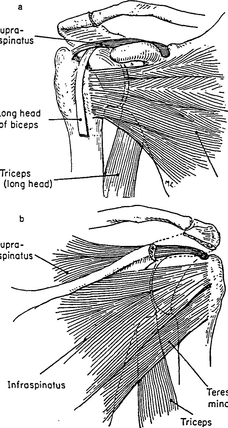 Anterior view of muscles of shoulder joint, superficial layer.